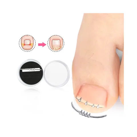 Corrector voor ingegroeide teennagels – afbeelding 1