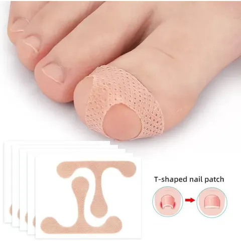 INF Patchs correcteurs d'orteils, bandage de correction des ongles incarnés – image 2